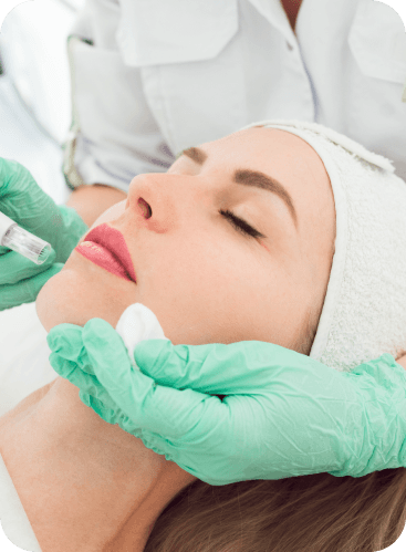 Microneedling Behandlung